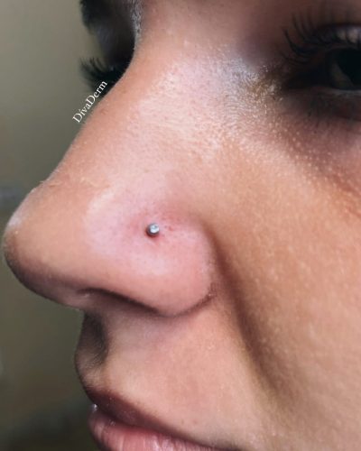 Orr piercing 1
