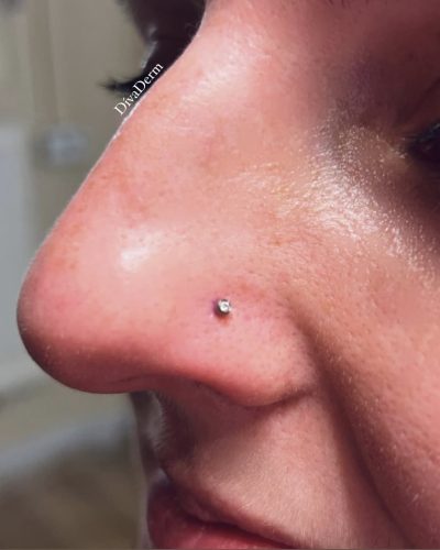 Orr piercing 3